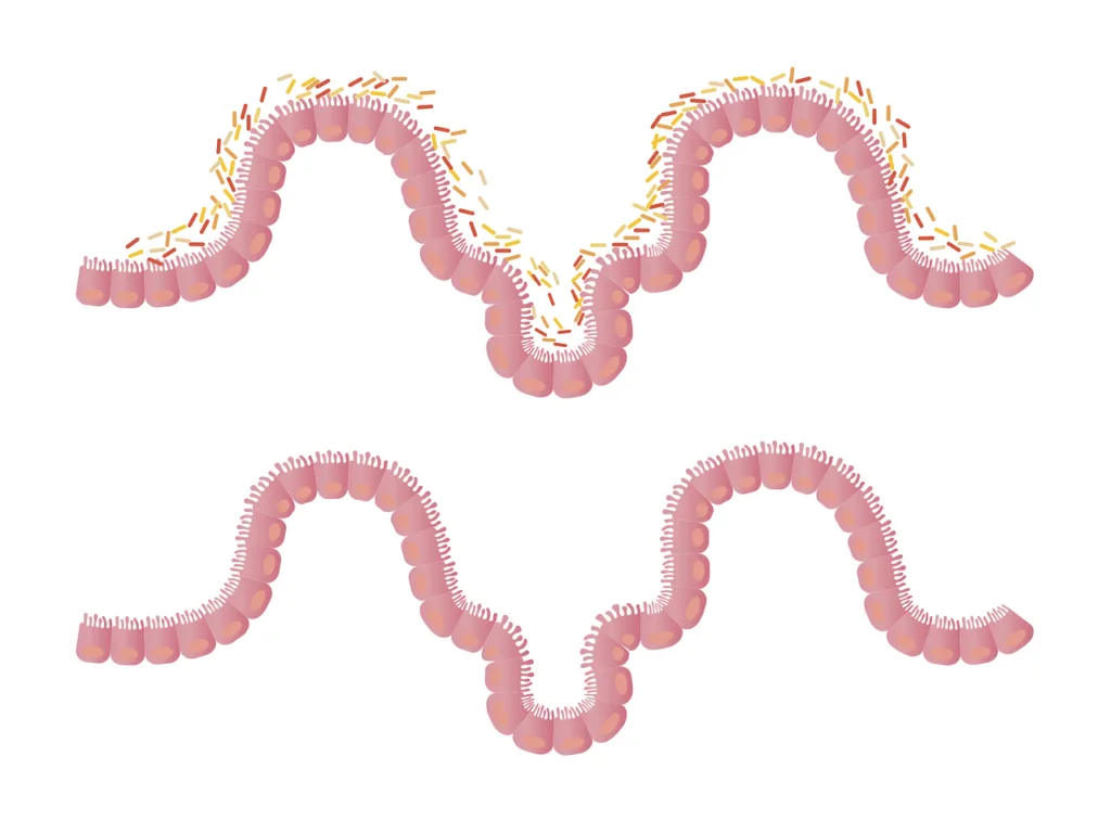 intestines, gut, flora