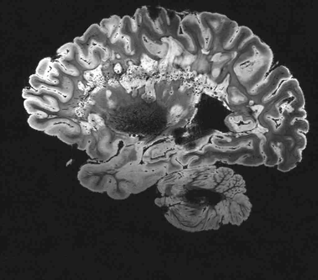 25 Fun Facts About Helium That will Will Surprise You 4 Mri scan": fun facts about helium