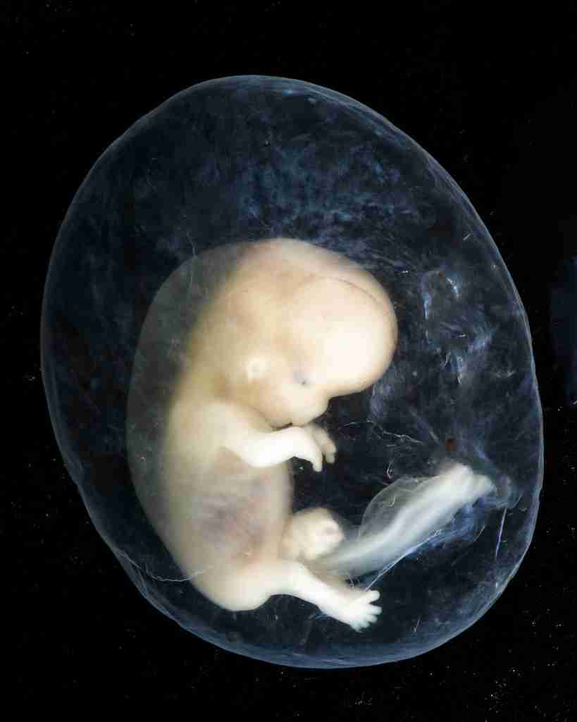 The nervous system starts developing early in the embryonic stage. Fun Facts About Nervous System